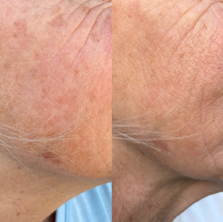 Radiant Glow Serum – Enhance Your True Beauty