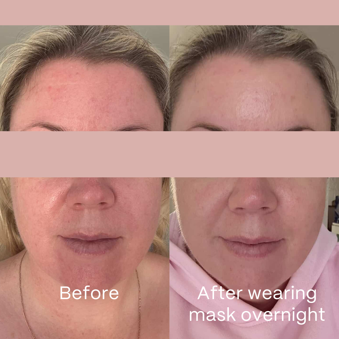 Glow Hydrogel Mask 4 Pack