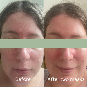 Soothe Hydrogel Mask 4 Pack