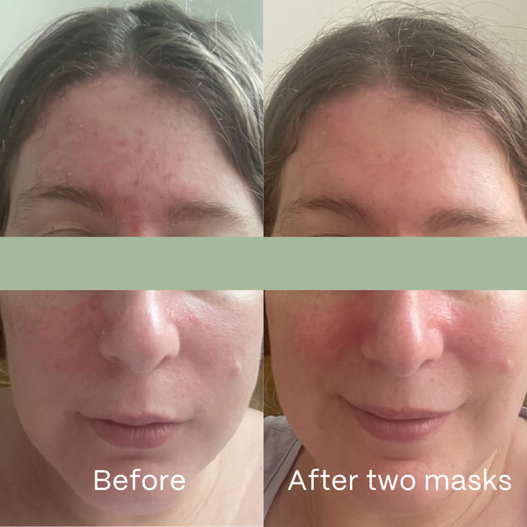 Soothe Hydrogel Mask 4 Pack