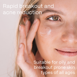UltraClear Acne Kit