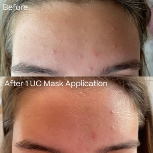 UltraClear Hydrogel Mask 4 Pack