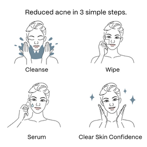 UltraClear Acne Kit