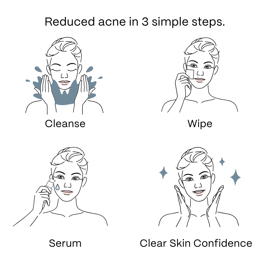 UltraClear Acne Kit