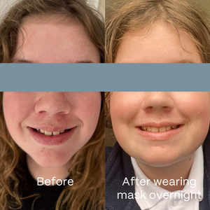 UltraClear Hydrogel Mask 4 Pack