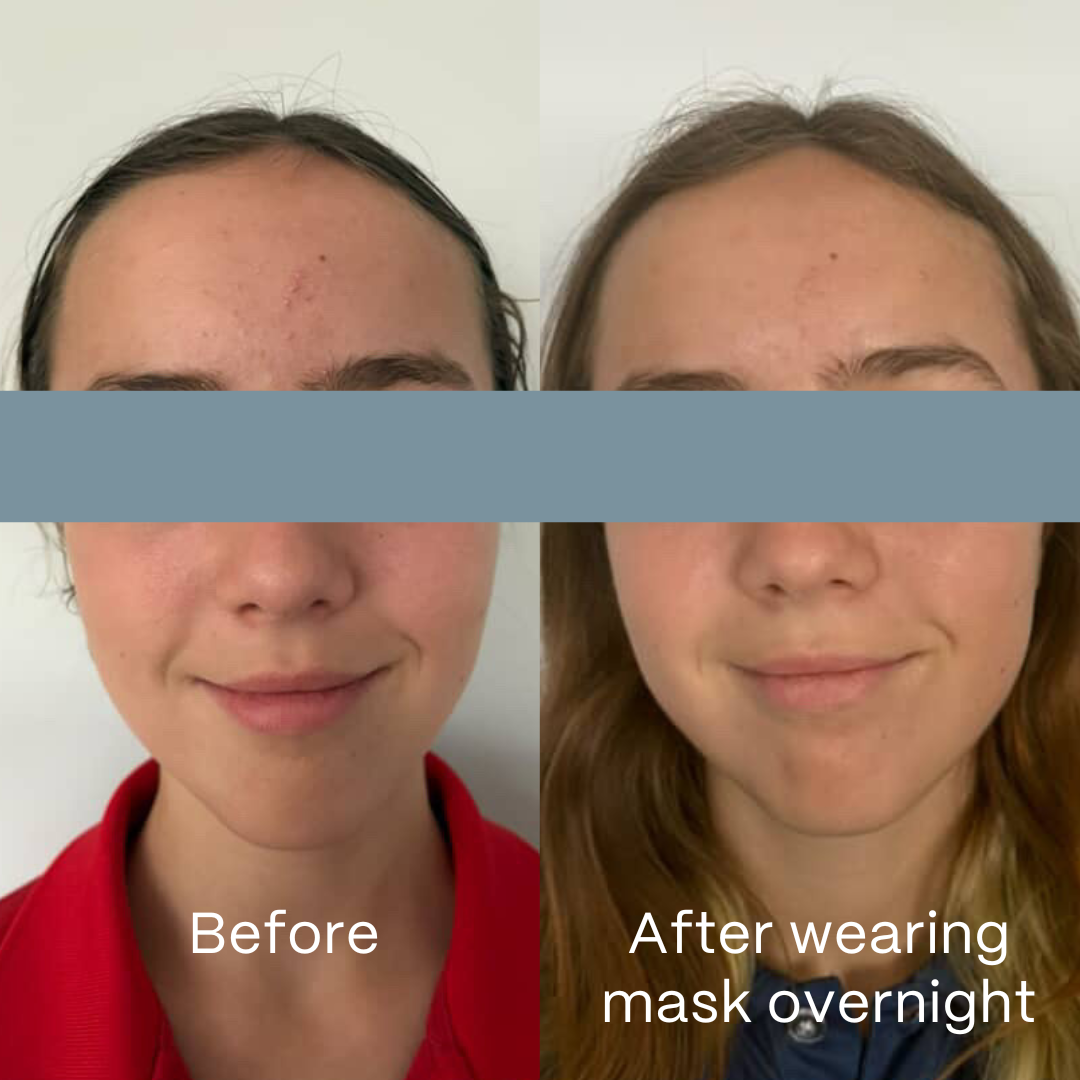 UltraClear Hydrogel Mask 4 Pack