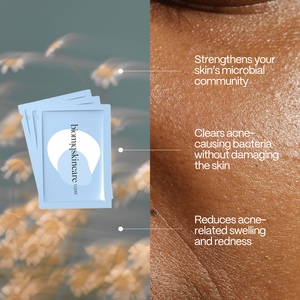 Rapid Clear Acne Wipes
