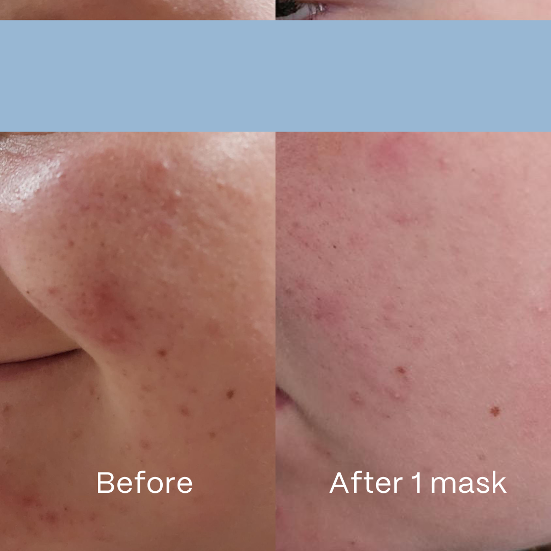 Clear Hydrogel Mask 4 Pack