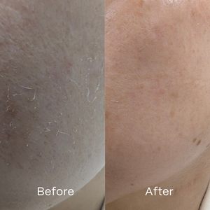 Soothe Hydrogel Mask 4 Pack