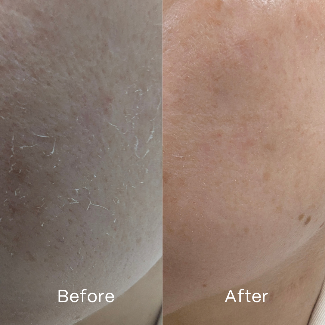 Soothe Hydrogel Mask 4 Pack